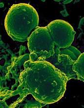 Antibiotic resistance is on the rise, leading to warnings from major health organizations.